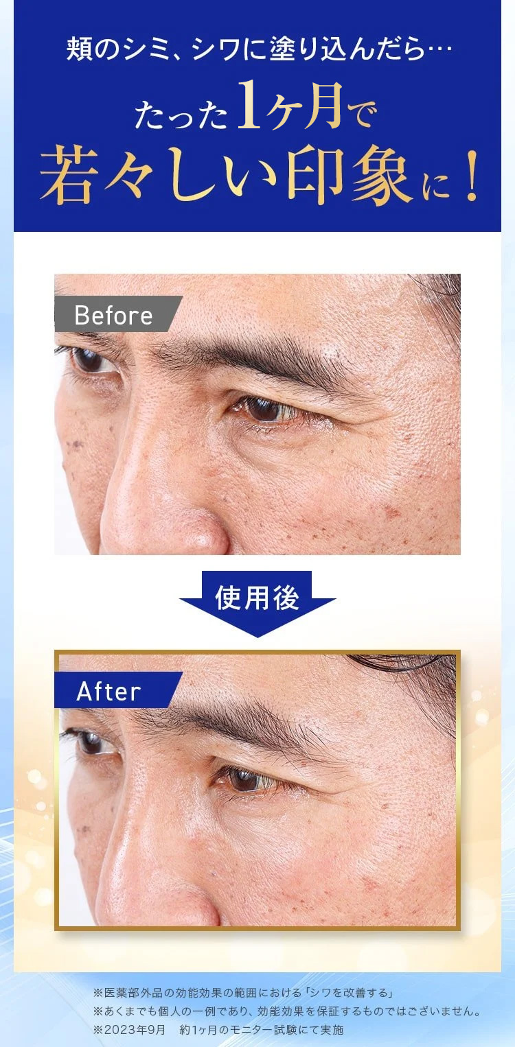 たった１カ月で若々しい印象に
