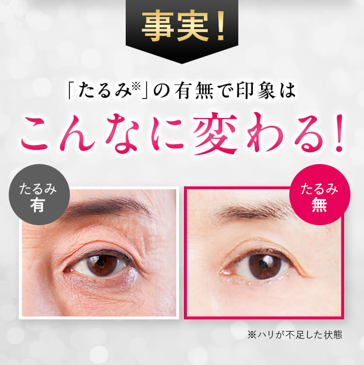 事実！「たるみ※」の有無で印象はこんなに変わる！