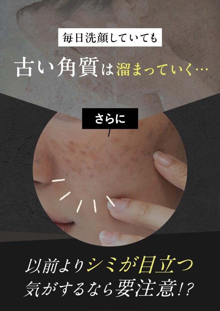 毎日洗顔していても古い角質は溜まっていく… さらに、以前よりシミが目立つ気がするなら要注意！？