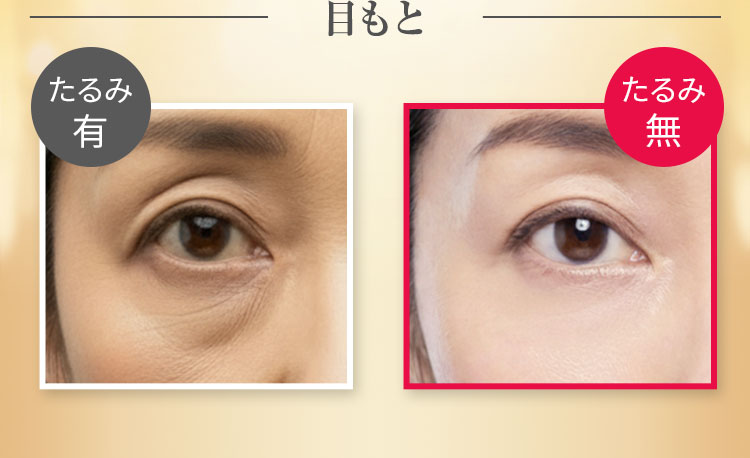 目もとの比較画像