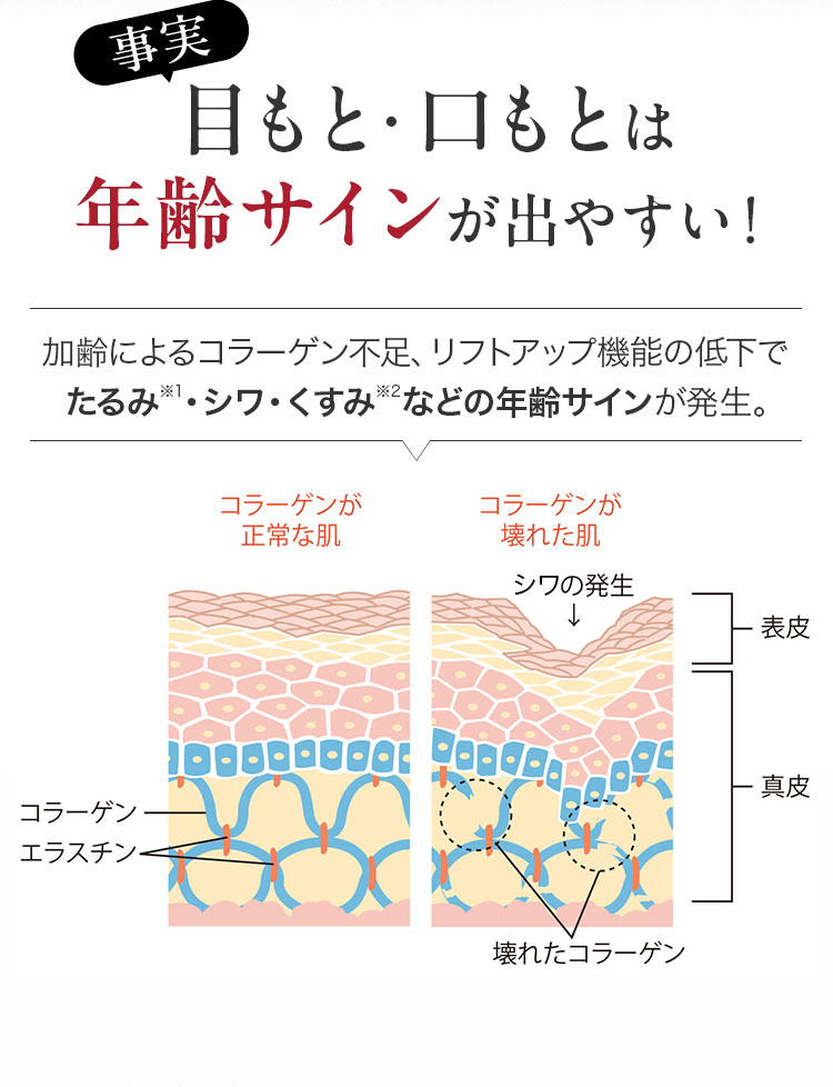 目もと・口もとは年齢サインが出やすい！