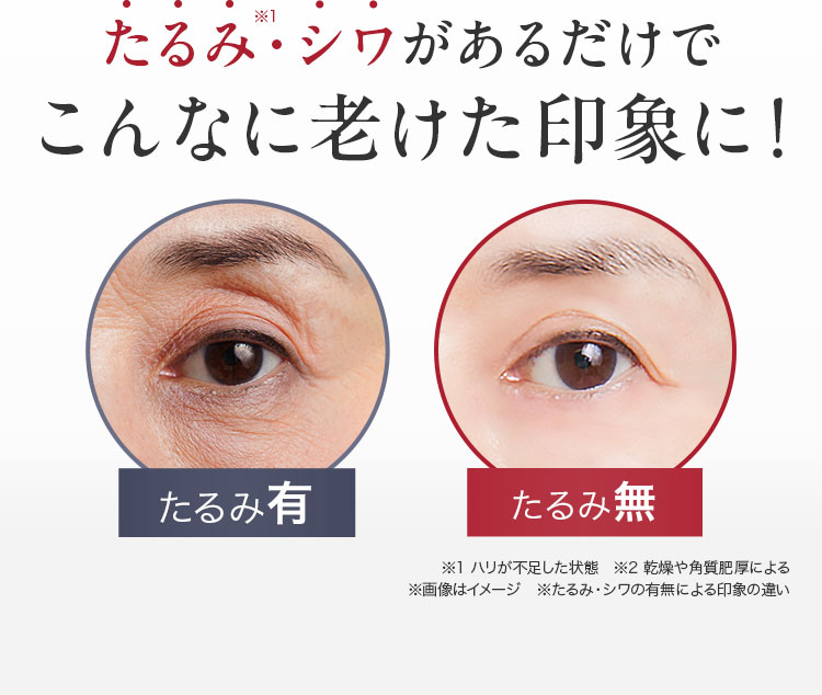 たるみ・シワがあるだけでこんなに老けた印象に！