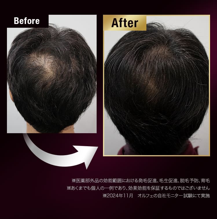 Before after