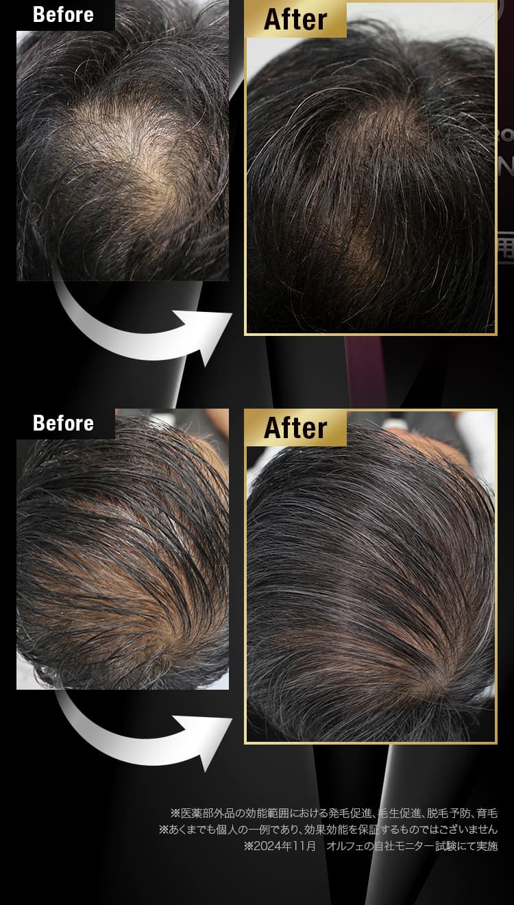 Before after