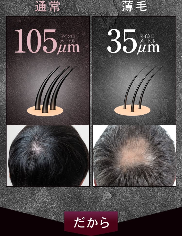 通常105μｍ 薄毛35μｍだから
