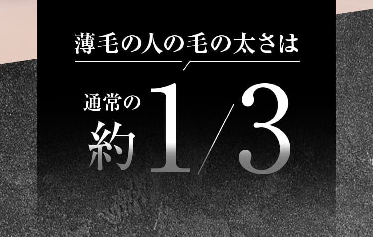 薄毛の人の毛の太さは通常の約1/3