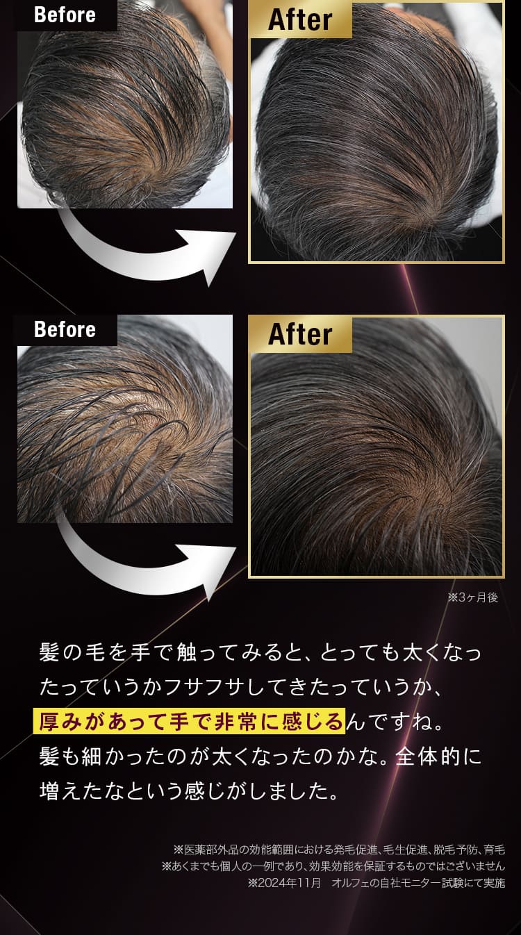 Before after 髪の毛を手で触ってみると、とっても太くなったっていうかフサフサしてきたっていうか、髪も細かったのが太くなったのかな。全体的に増えたなという感じがしました。