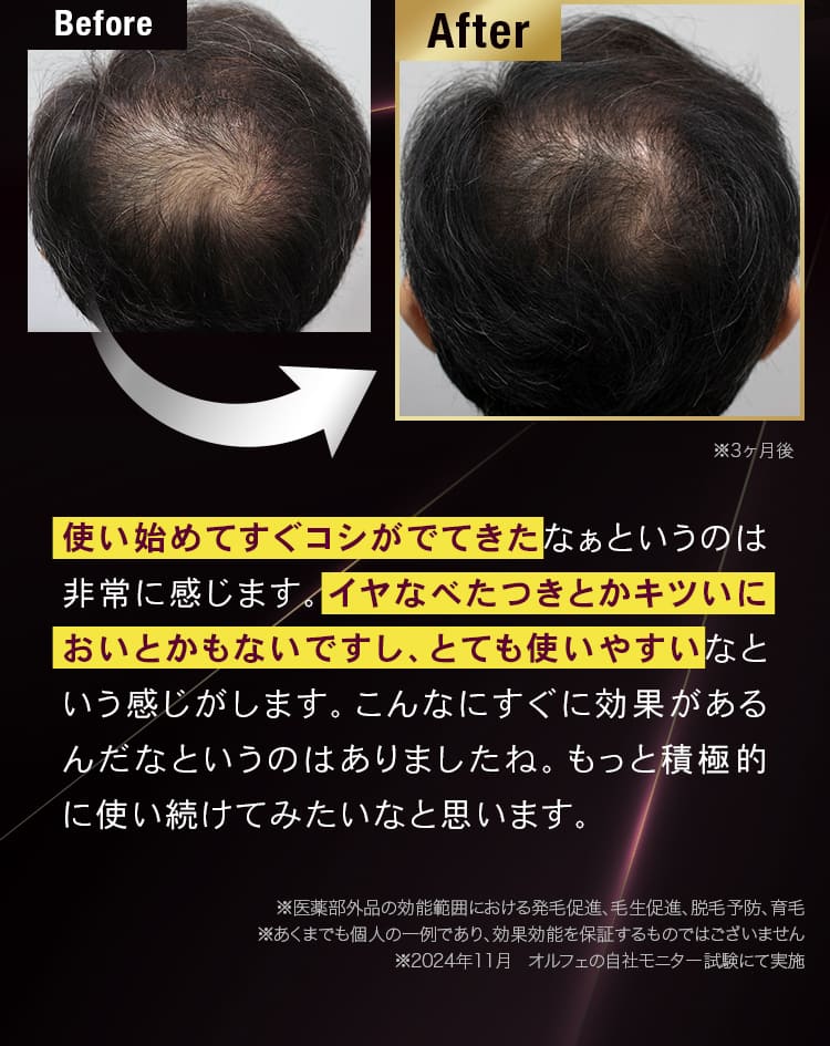 Before after 使い始めてすぐコシがでてきたなぁというのは非常に感じます。イヤなべたつきとかキツいにおいとかもないですし、とても使いやすいなという感じがします。こんなにすぐに効果があるんだなというのはありましたね。もっと積極的に使い続けてみたいなと思います。