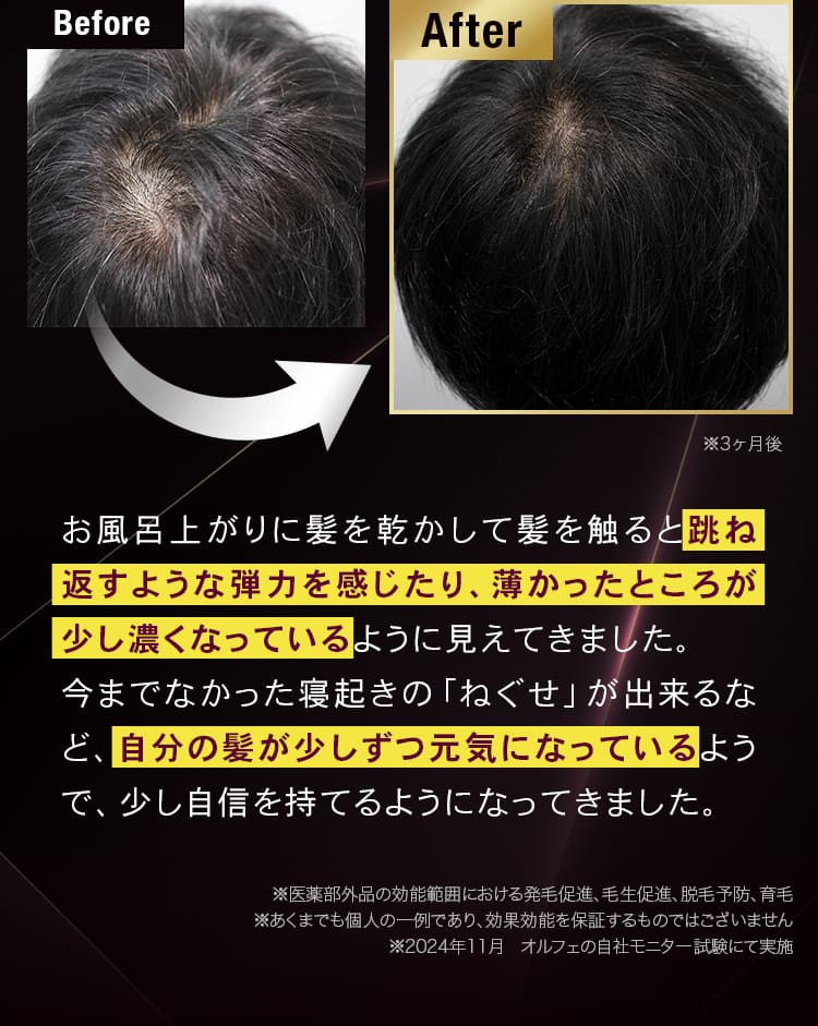 Before after お風呂上がりに髪を乾かして髪を触ると跳ね返すような弾力を感じたり、薄かったところが少し濃くなっているように見えてきました。今までなかった寝起きの「ねぐせ」が出来るなど、自分の髪が少しずつ元気になっているようで、少し自信を持てるようになってきました。
