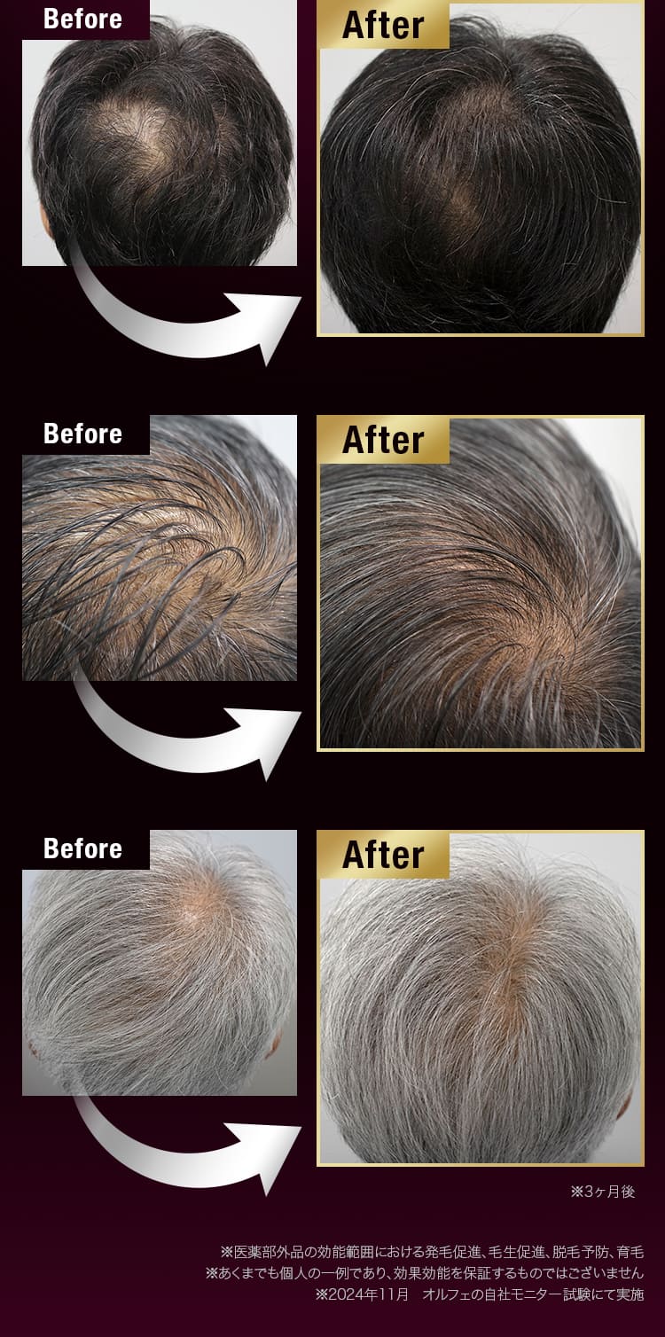 Before after